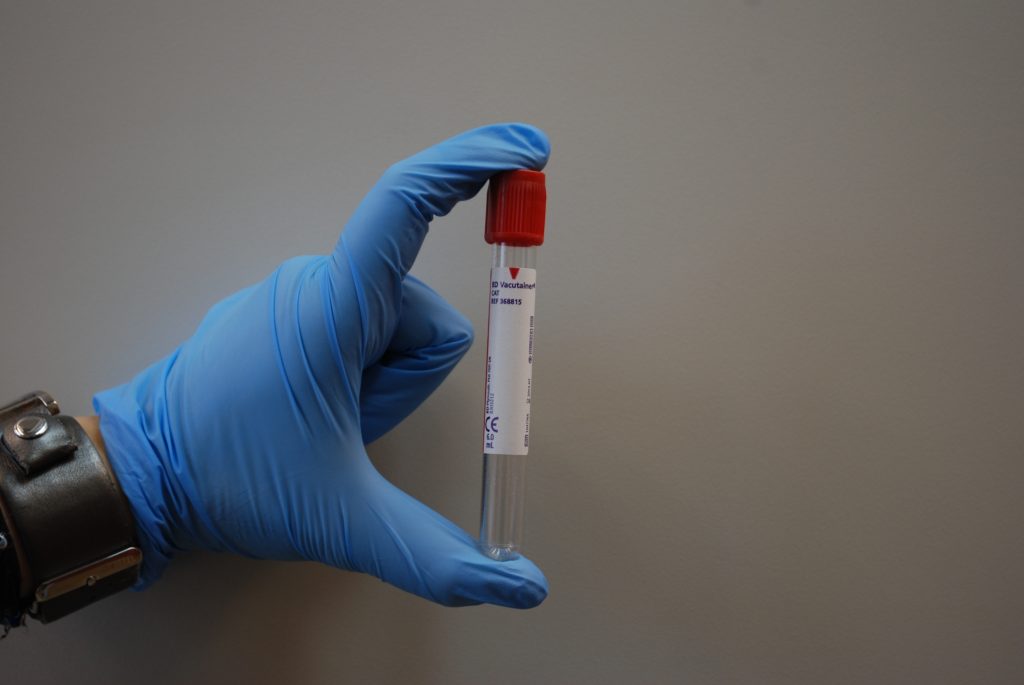 Monitoraggio Immunitario di Massa per il Personale Sanitario della ASL Salerno