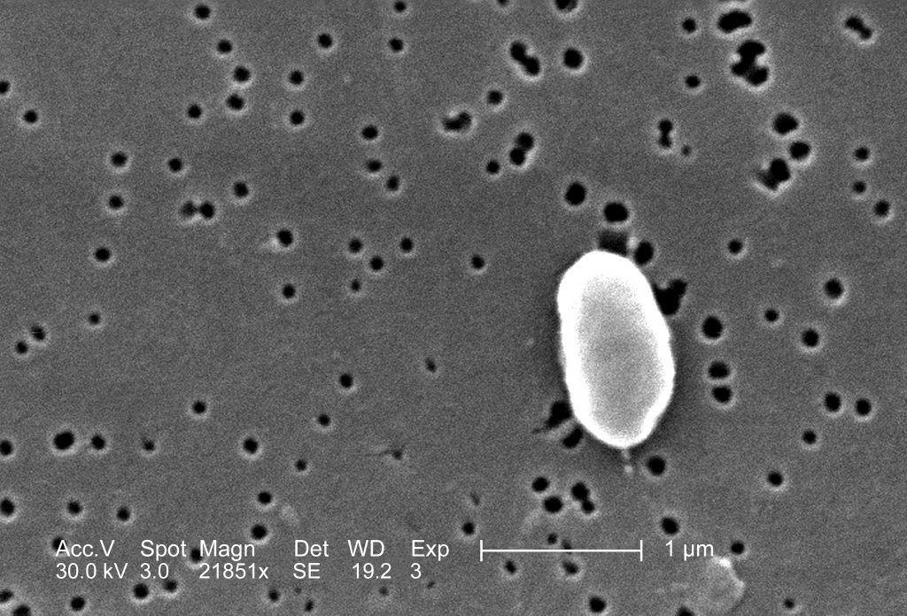 Nuova Speranza nella Lotta al Cancro del Colon-Retto: Il Ruolo dei Batteri Intestinali