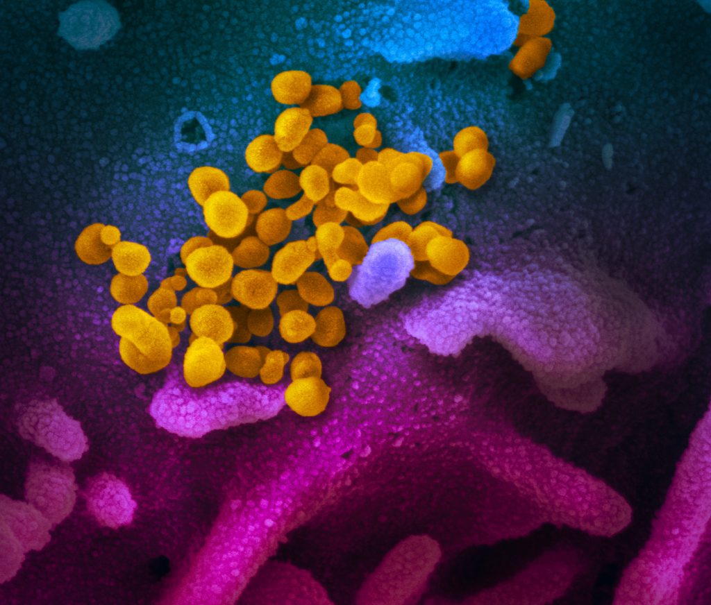 Restrizioni alla circolazione a Nocera Inferiore per contenere il contagio da COVID-19