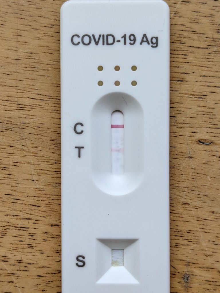 # Campania lancia screening di massa con test rapidi anti-COVID-19
