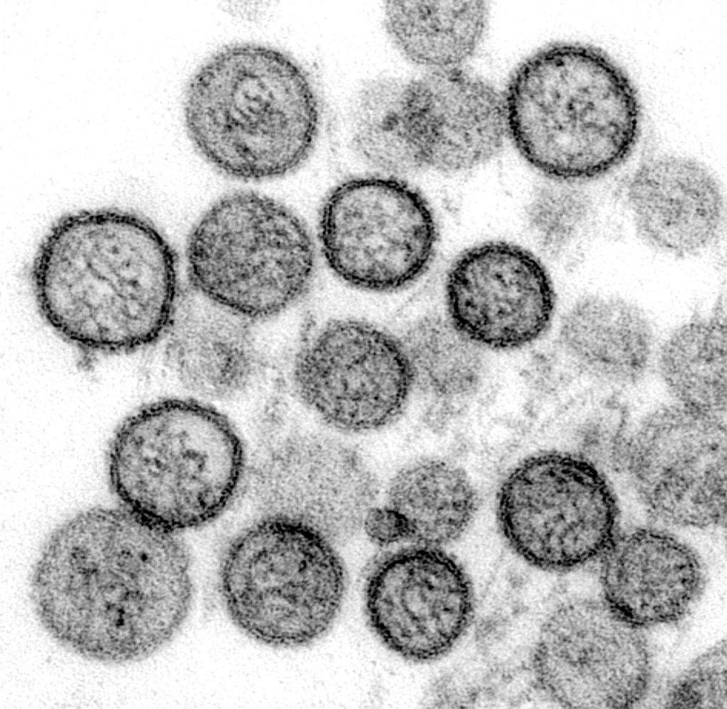 Una nuova variante Covid-19, Deltacron, emerge a Cipro