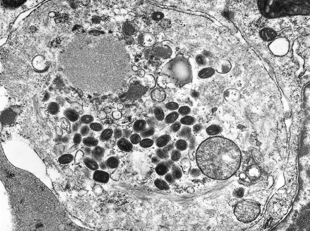 Trasferimento del reparto di Dermatologia: nuove sedi e servizi per i pazienti del Ruggi