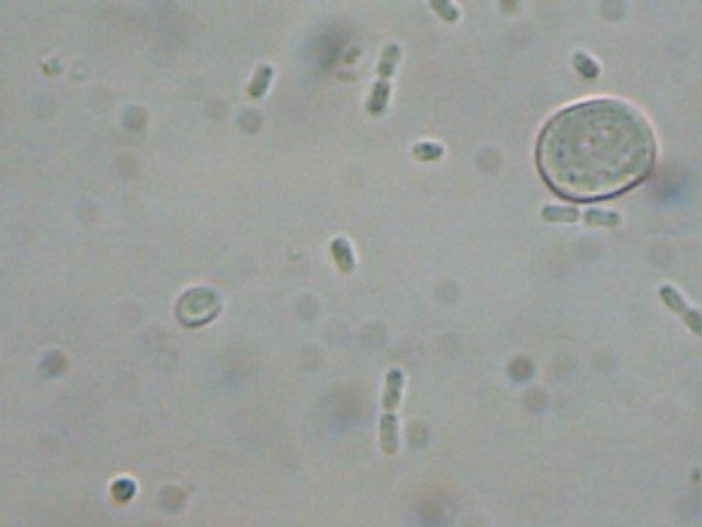 Livelli di Escherichia coli nel Sarno fuori scala: indagini in corso