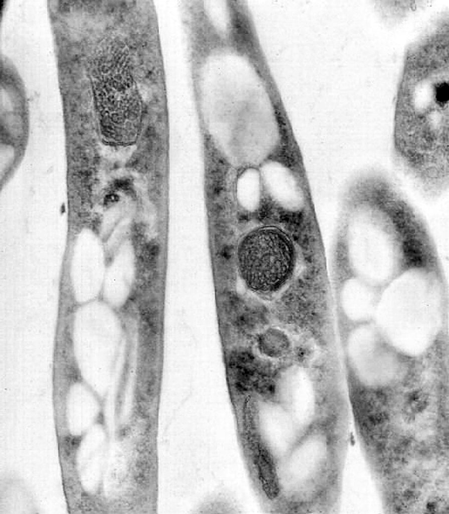 L’impegno di Sonia Angrisani per la salute: un convegno e una raccolta fondi per le malattie infiammatorie croniche intestinali