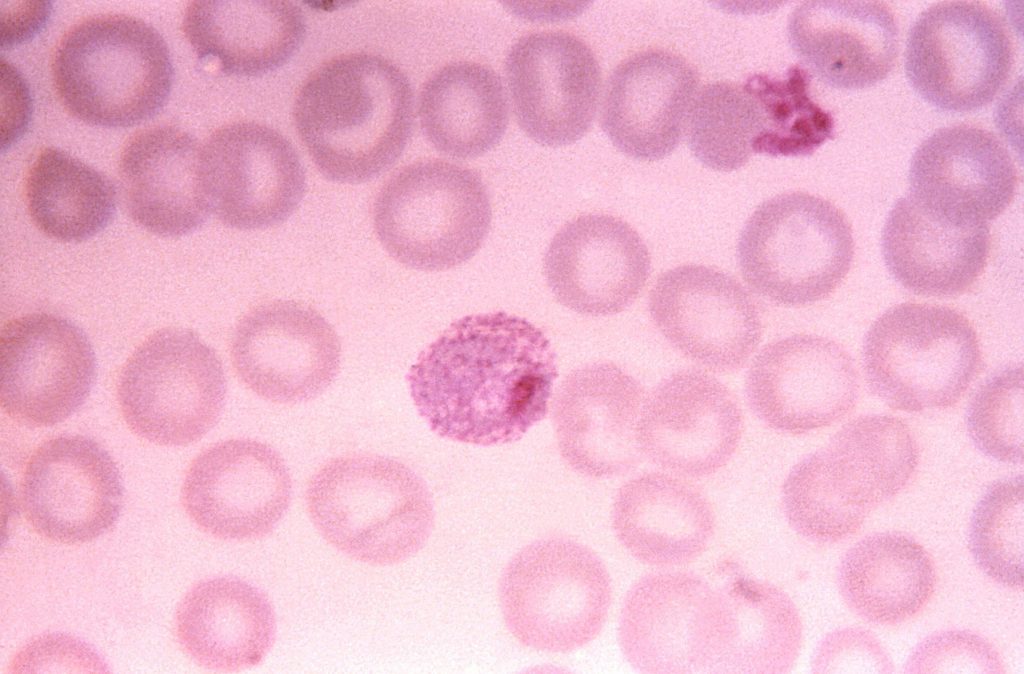 Prevenzione gratuita del papillomavirus a Nocera Inferiore: due giorni di screening