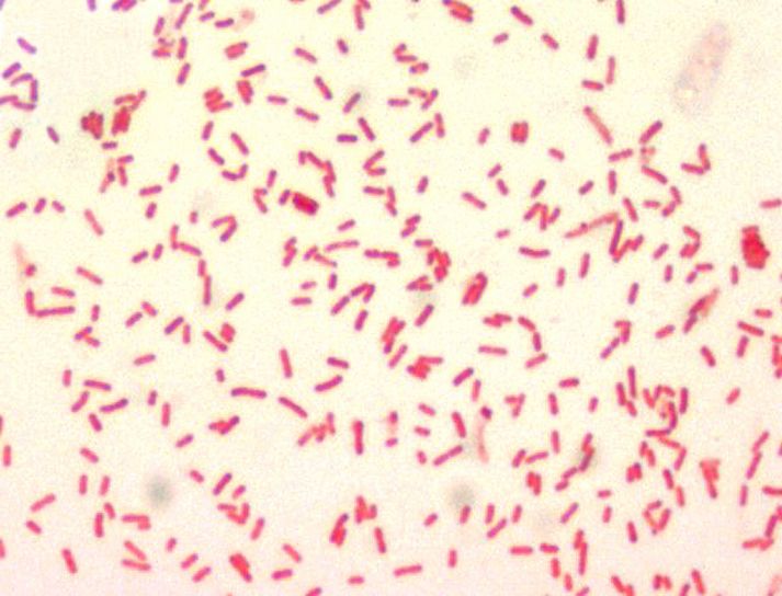 Grave infezione polmonare: paziente in coma a Nocera Inferiore