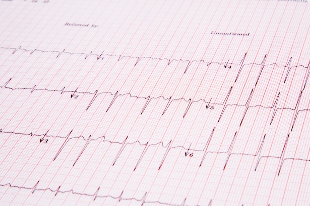 Il futuro incerto dei servizi di Cardiologia Interventistica a Nocera Inferiore ed Eboli