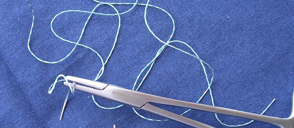 Chirurgia bariatrica: un approccio ERAbS per un recupero più rapido e sereno