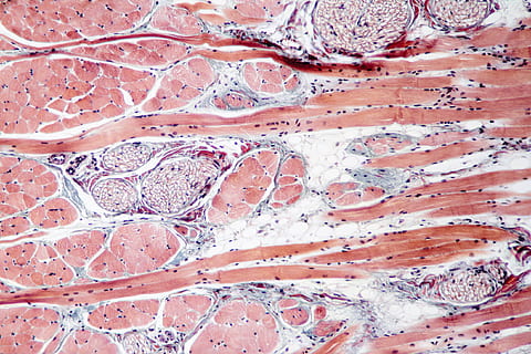 Mito Sfatato: Le Proteine e la Crescita Muscolare