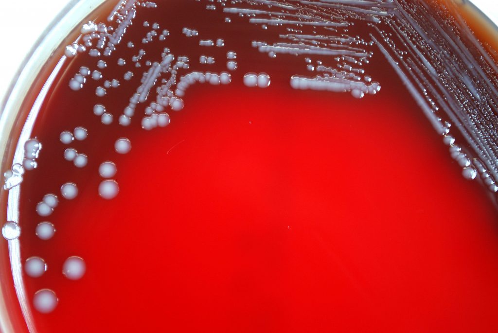 Indagine sulla contaminazione ambientale nella Valle del Sarno: chiamata a volontari